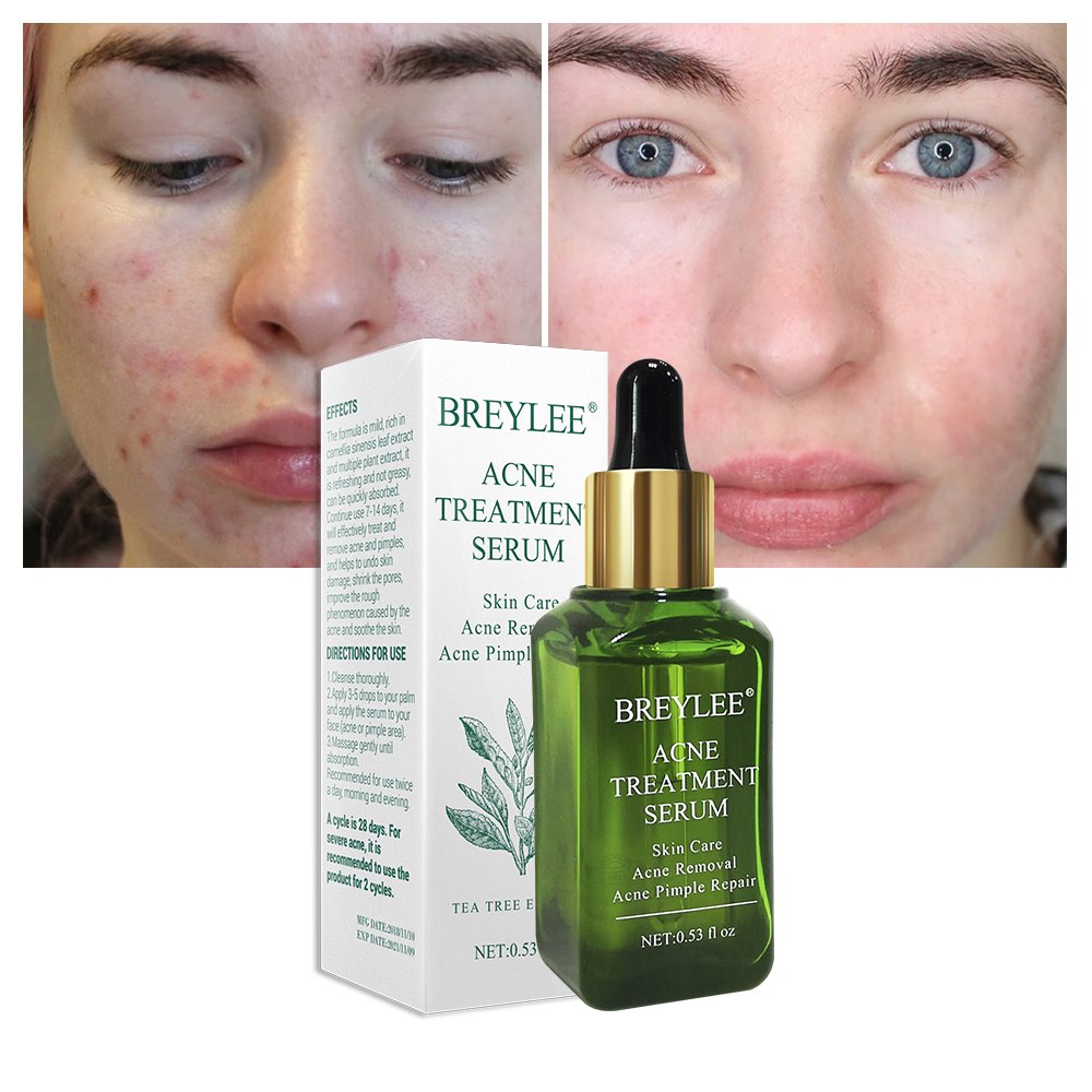 8c2b7178b8d4197984ba88313e851693